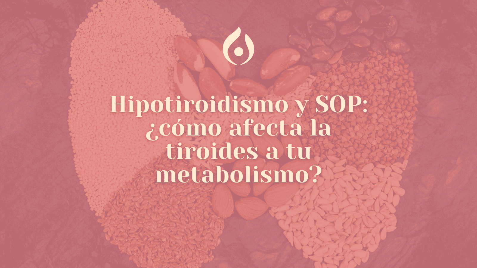 Hipotiroidismo y SOP